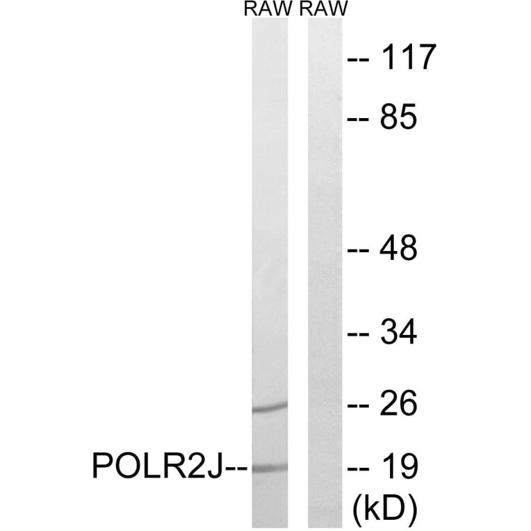 Western Blot - Anti-RPB11 Antibody (C15467) - Antibodies.com