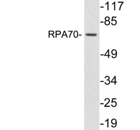 Western Blot - Anti-RPA70 Antibody (R12-2337) - Antibodies.com