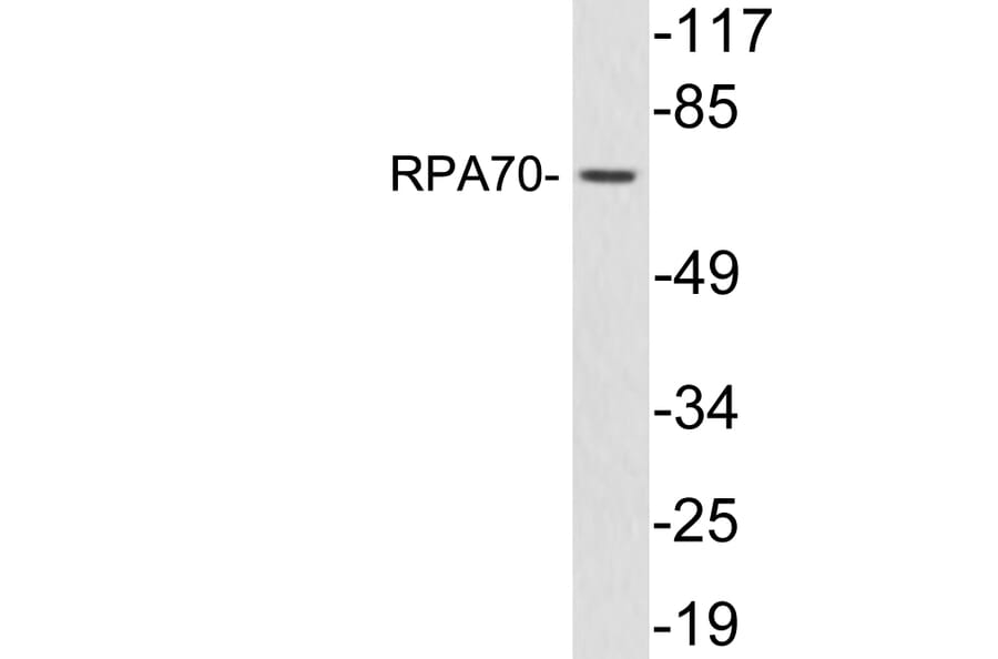 Western Blot - Anti-RPA70 Antibody (R12-2337) - Antibodies.com