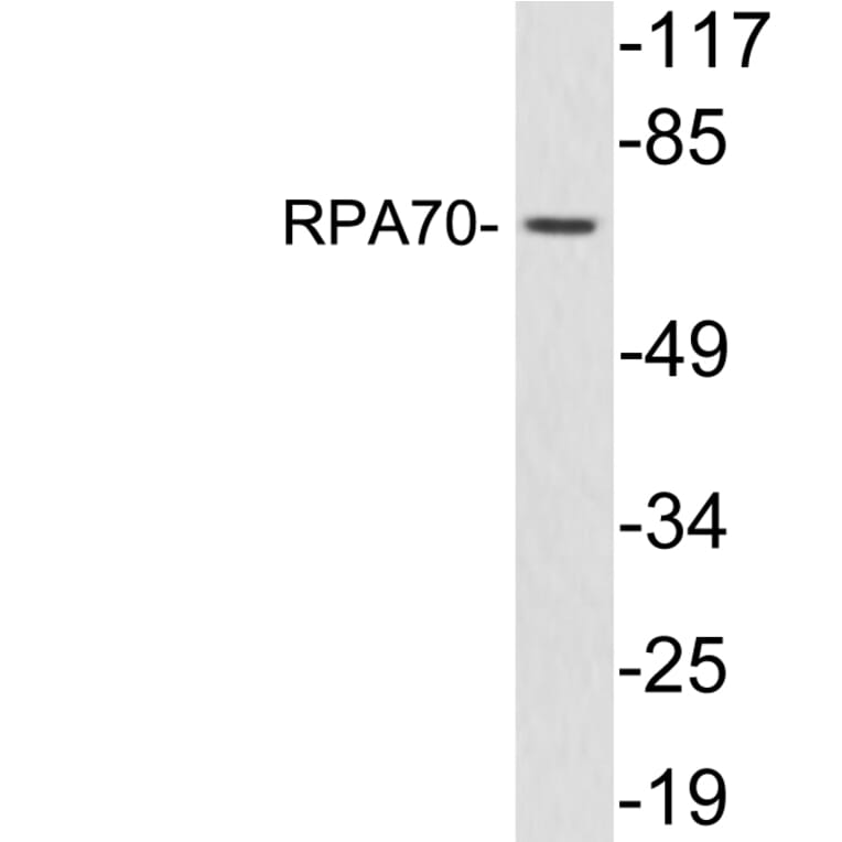 Western Blot - Anti-RPA70 Antibody (R12-2337) - Antibodies.com