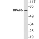 Western Blot - Anti-RPA70 Antibody (R12-2337) - Antibodies.com