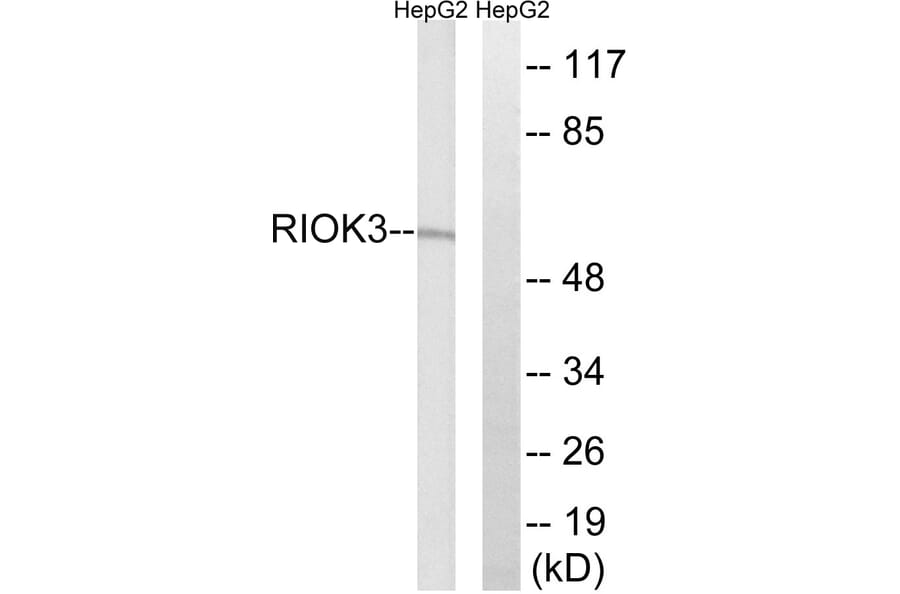 Western Blot - Anti-RIOK3 Antibody (C18608) - Antibodies.com
