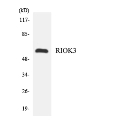 Western Blot - Anti-RIOK3 Antibody (R12-3443) - Antibodies.com