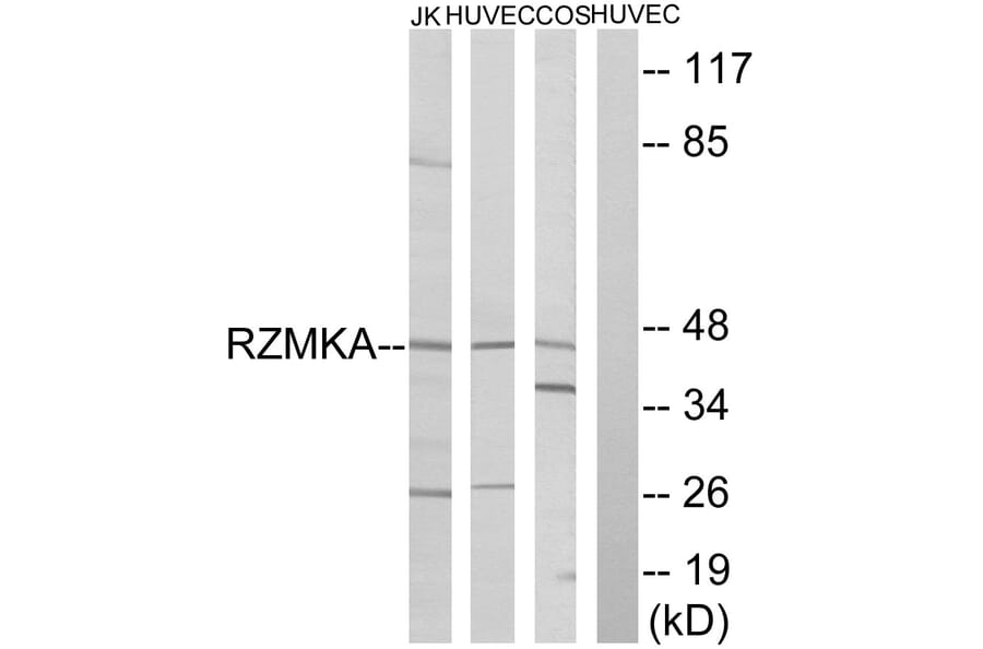Western Blot - Anti-RIMKA Antibody (C18431) - Antibodies.com