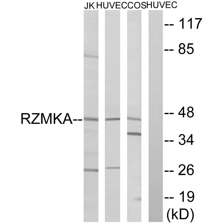 Western Blot - Anti-RIMKA Antibody (C18431) - Antibodies.com