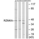 Western Blot - Anti-RIMKA Antibody (C18431) - Antibodies.com