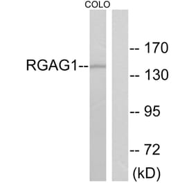 Western Blot - Anti-RGAG1 Antibody (C11369) - Antibodies.com