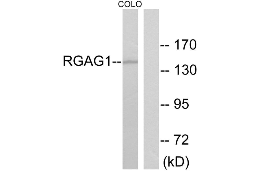 Western Blot - Anti-RGAG1 Antibody (C11369) - Antibodies.com