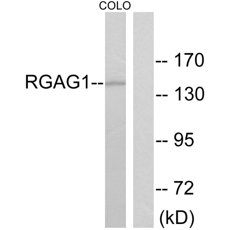 Western Blot - Anti-RGAG1 Antibody (C11369) - Antibodies.com