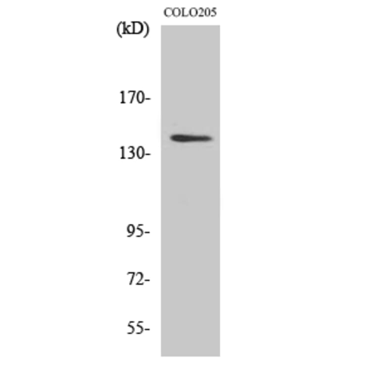 Western Blot - Anti-RGAG1 Antibody (C11369) - Antibodies.com