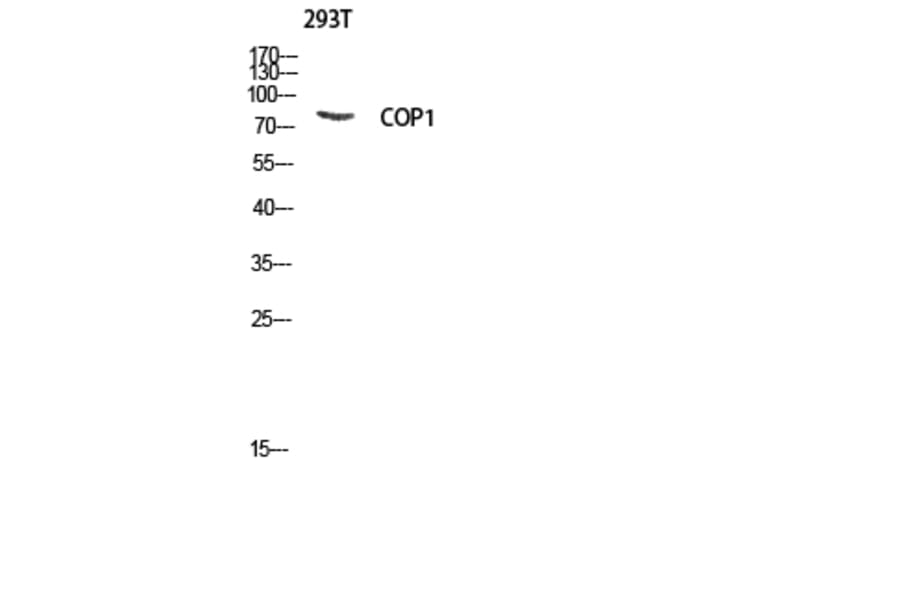 Western Blot - Anti-RFWD2 Antibody (B8412) - Antibodies.com