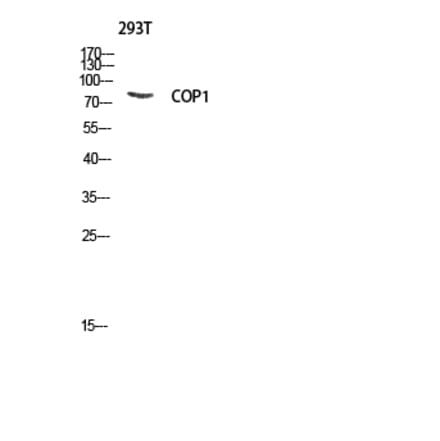 Western Blot - Anti-RFWD2 Antibody (B8412) - Antibodies.com