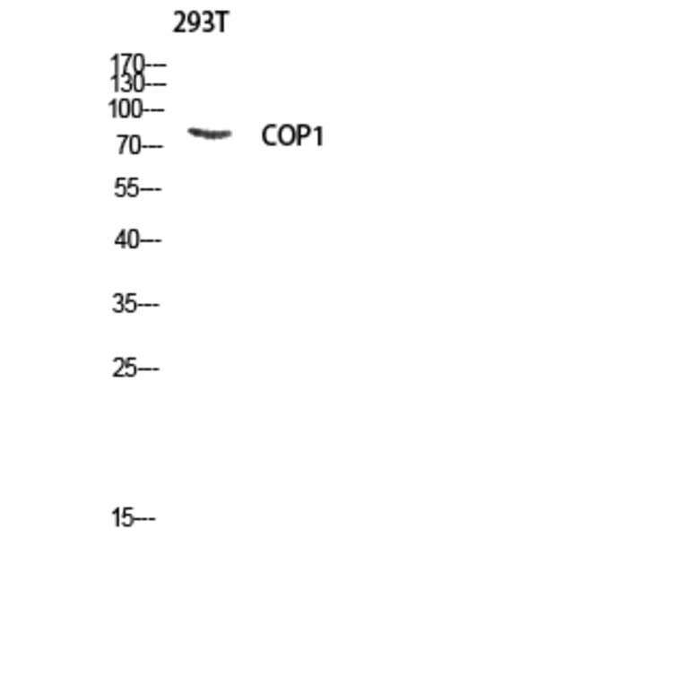 Western Blot - Anti-RFWD2 Antibody (B8412) - Antibodies.com