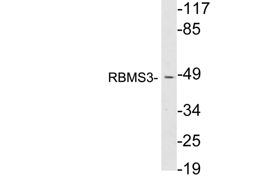Western Blot - Anti-RBMS3 Antibody (R12-2331) - Antibodies.com