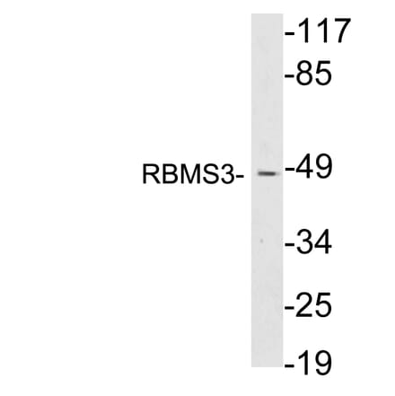 Western Blot - Anti-RBMS3 Antibody (R12-2331) - Antibodies.com