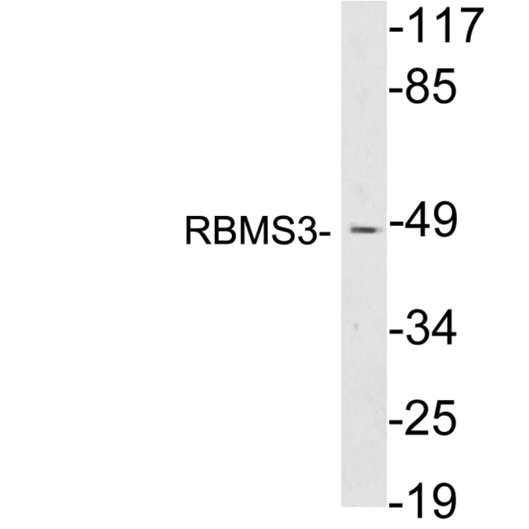Western Blot - Anti-RBMS3 Antibody (R12-2331) - Antibodies.com