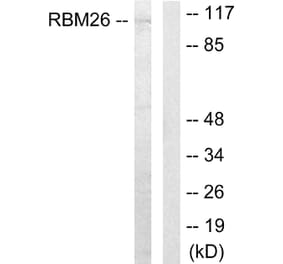 Western Blot - Anti-RBM26 Antibody (C11188) - Antibodies.com