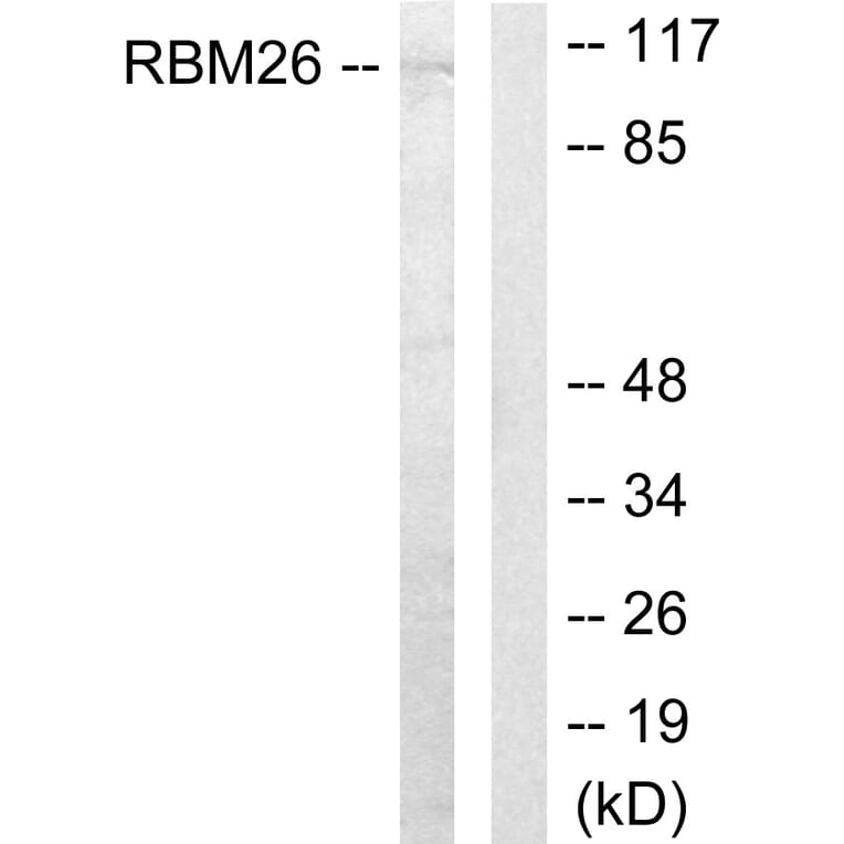 Western Blot - Anti-RBM26 Antibody (C11188) - Antibodies.com