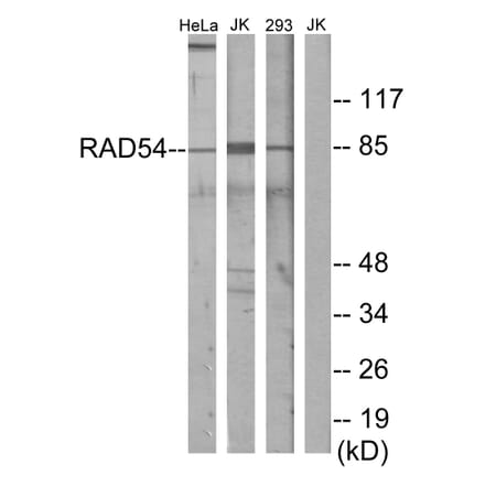 Western Blot - Anti-RAD54 Antibody (C13112) - Antibodies.com