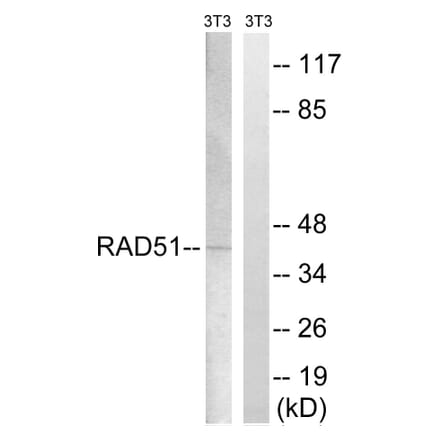 Western Blot - Anti-RAD51 Antibody (B8410) - Antibodies.com