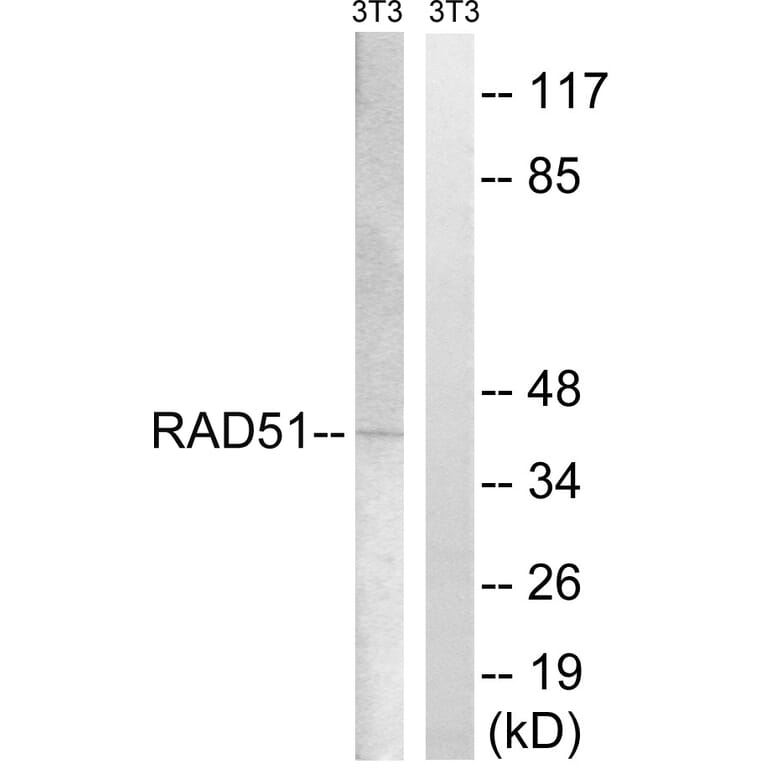 Western Blot - Anti-RAD51 Antibody (B8410) - Antibodies.com