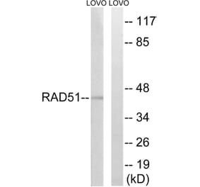 Western Blot - Anti-RAD51 Antibody (B1117) - Antibodies.com