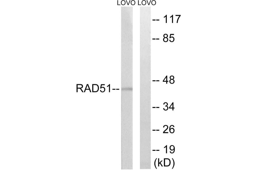 Western Blot - Anti-RAD51 Antibody (B1117) - Antibodies.com