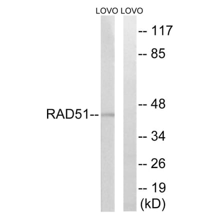Western Blot - Anti-RAD51 Antibody (B1117) - Antibodies.com