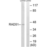 Western Blot - Anti-RAD51 Antibody (B1117) - Antibodies.com