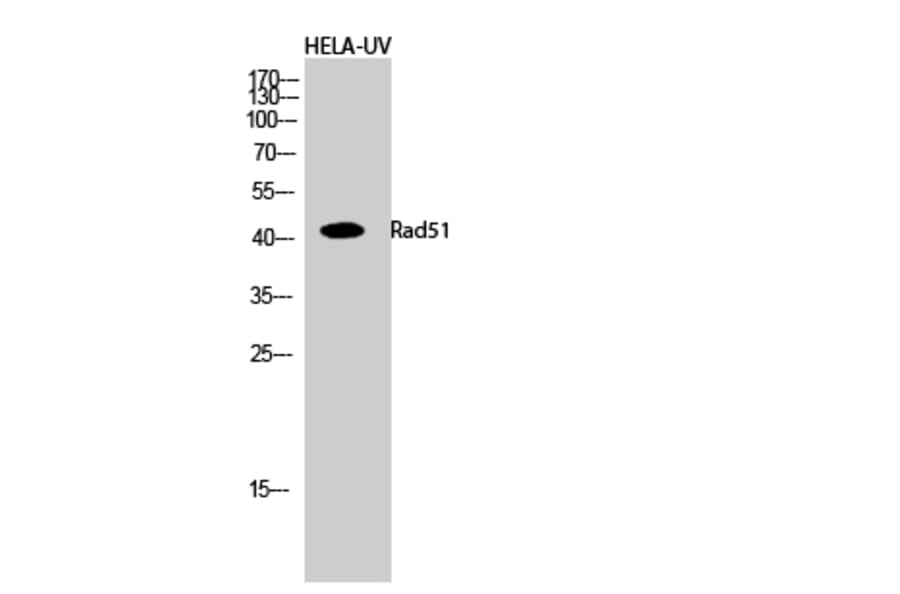 Western Blot - Anti-RAD51 Antibody (B1117) - Antibodies.com
