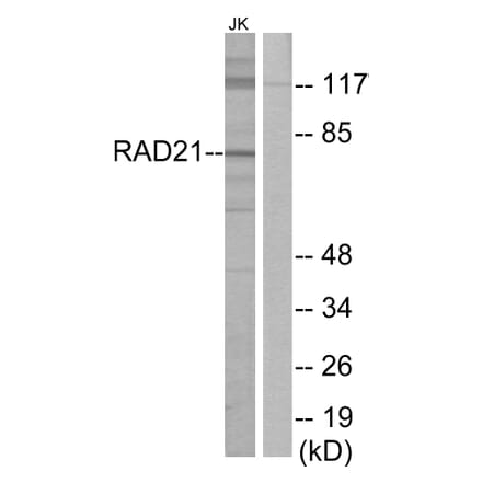 Western Blot - Anti-RAD21 Antibody (C13110) - Antibodies.com