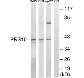 Western Blot - Anti-PSMC6 Antibody (C14017) - Antibodies.com