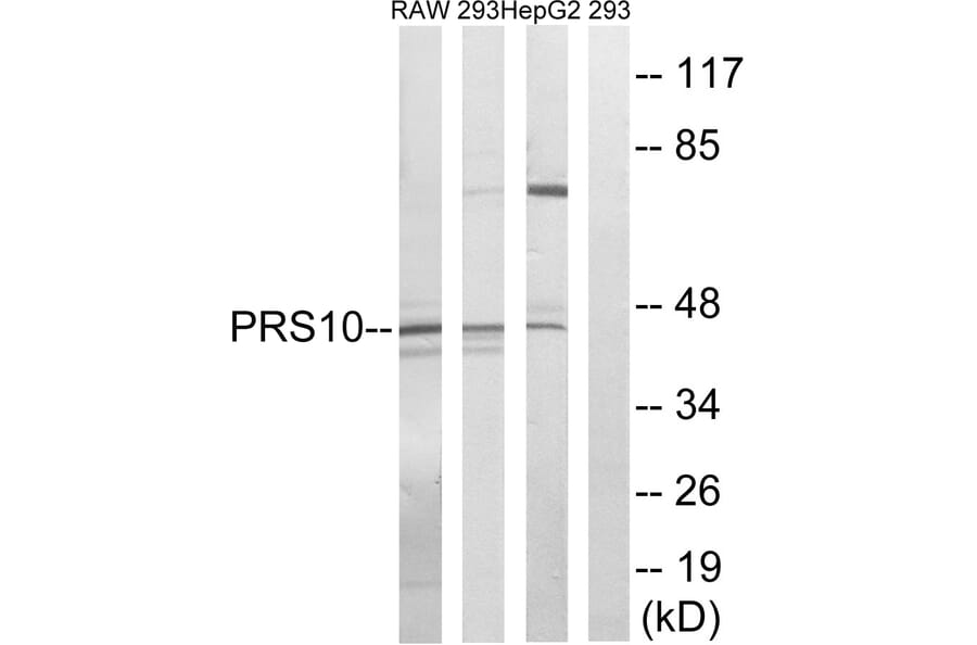 Western Blot - Anti-PSMC6 Antibody (C14017) - Antibodies.com