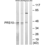 Western Blot - Anti-PSMC6 Antibody (C14017) - Antibodies.com