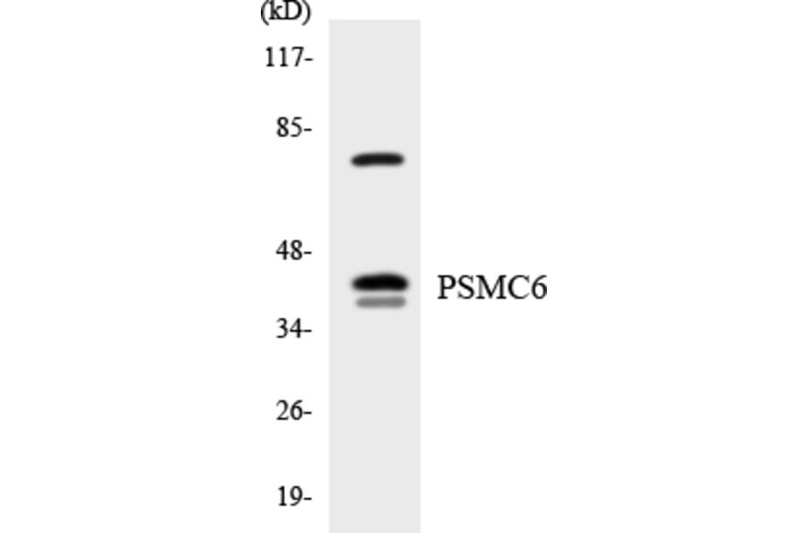 Western Blot - Anti-PSMC6 Antibody (R12-3377) - Antibodies.com