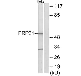 Western Blot - Anti-PRP31 Antibody (C11412) - Antibodies.com