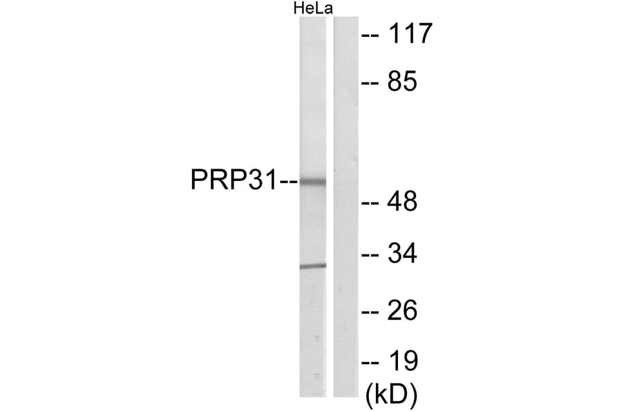 Western Blot - Anti-PRP31 Antibody (C11412) - Antibodies.com