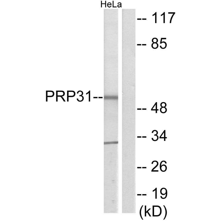 Western Blot - Anti-PRP31 Antibody (C11412) - Antibodies.com