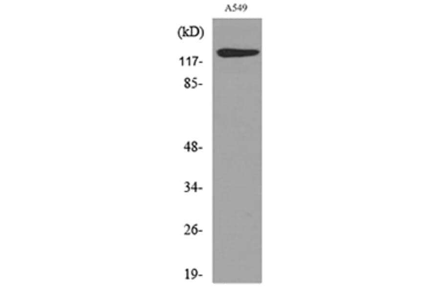 Western Blot - Anti-PROM1 Antibody (C30121) - Antibodies.com