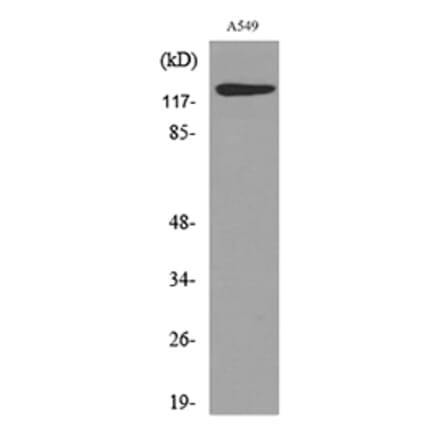 Western Blot - Anti-PROM1 Antibody (C30121) - Antibodies.com