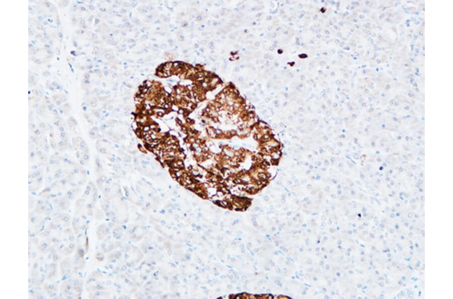 Immunohistochemistry - Anti-PROM1 Antibody (C30121) - Antibodies.com