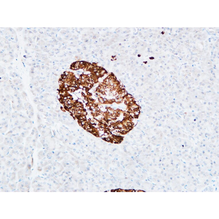 Immunohistochemistry - Anti-PROM1 Antibody (C30121) - Antibodies.com