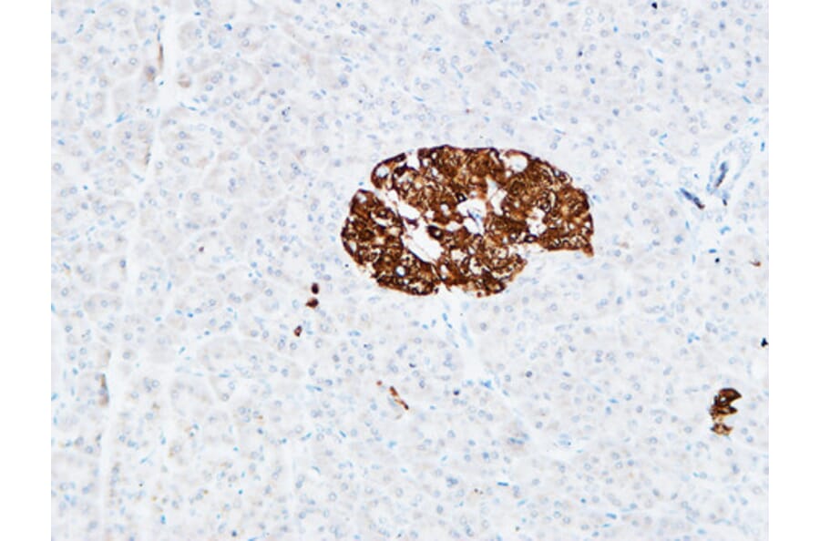 Immunohistochemistry - Anti-PROM1 Antibody (C30121) - Antibodies.com