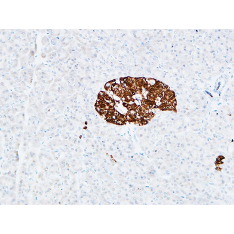 Immunohistochemistry - Anti-PROM1 Antibody (C30121) - Antibodies.com