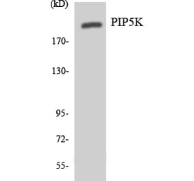 Western Blot - Anti-PIP5K Antibody (R12-3327) - Antibodies.com