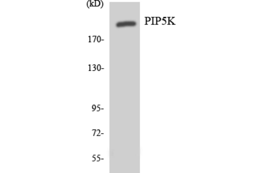 Western Blot - Anti-PIP5K Antibody (R12-3327) - Antibodies.com