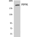 Western Blot - Anti-PIP5K Antibody (R12-3327) - Antibodies.com