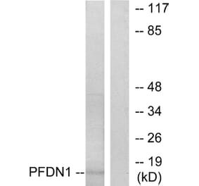 Western Blot - Anti-PFDN1 Antibody (C10158) - Antibodies.com