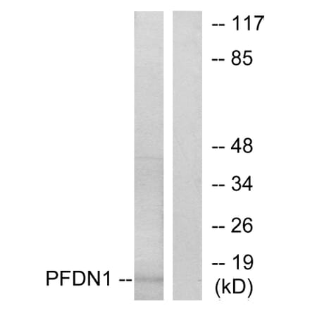 Western Blot - Anti-PFDN1 Antibody (C10158) - Antibodies.com