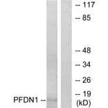 Western Blot - Anti-PFDN1 Antibody (C10158) - Antibodies.com